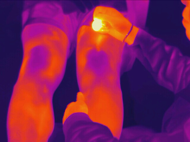 Medical Infrared Thermal Imaging Technology