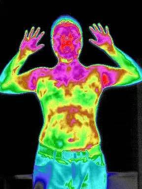 Infrared Thermal Imaging in Medical Diagnosis